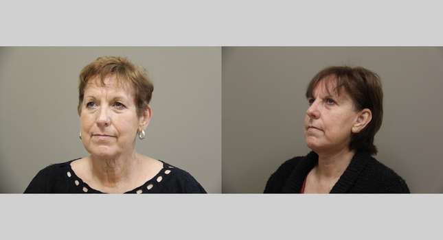 Facial Rejuvenation: Image #1118