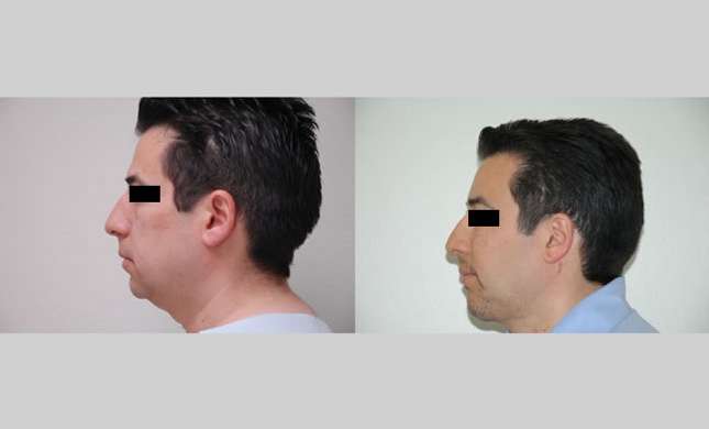 Facial Rejuvenation: Image #179
