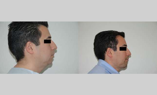 Facial Rejuvenation: Image #180