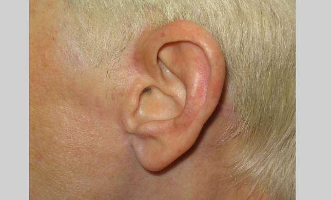 Facial Rejuvenation: Image #181