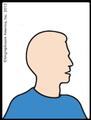 I need to rotate my head to the left each time I swallow
