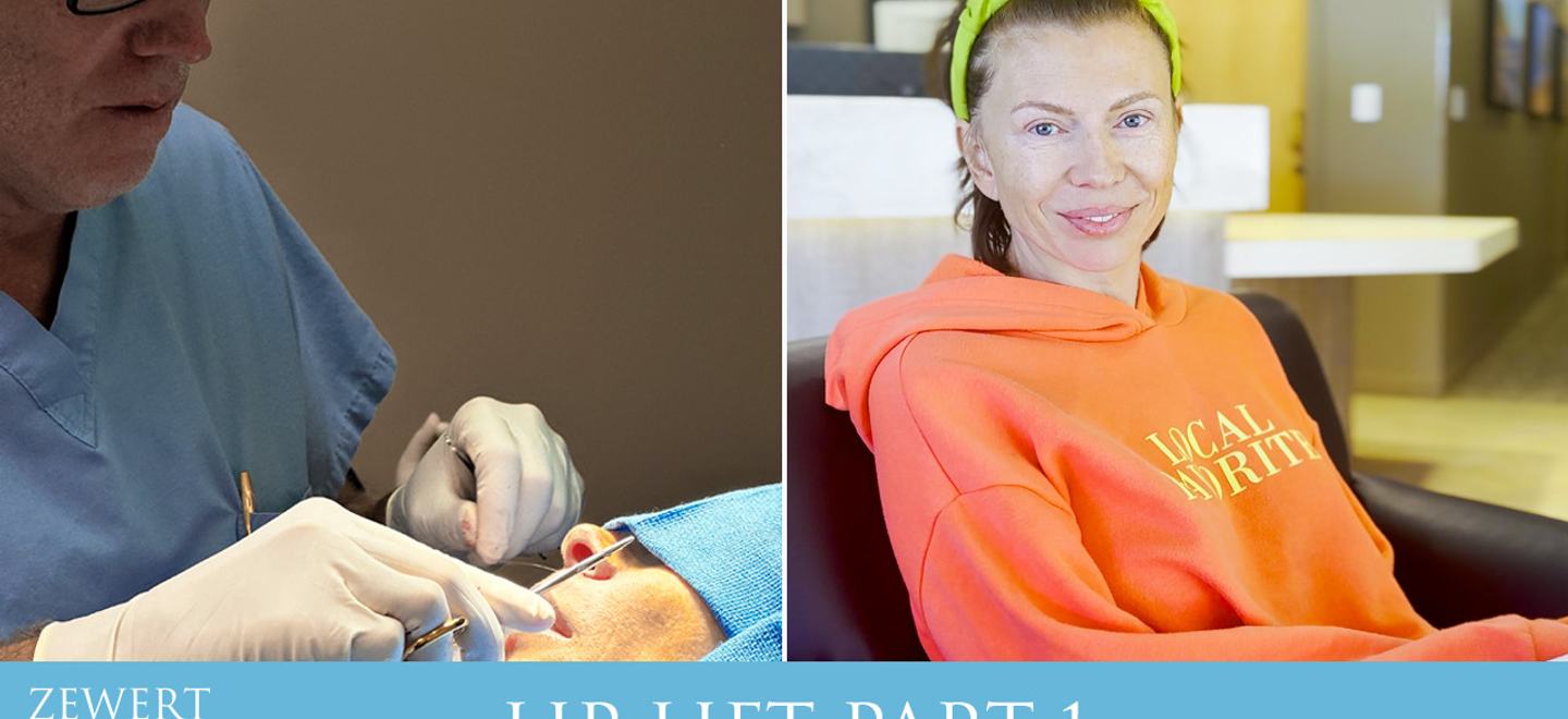 Lip Lift (Part 1)