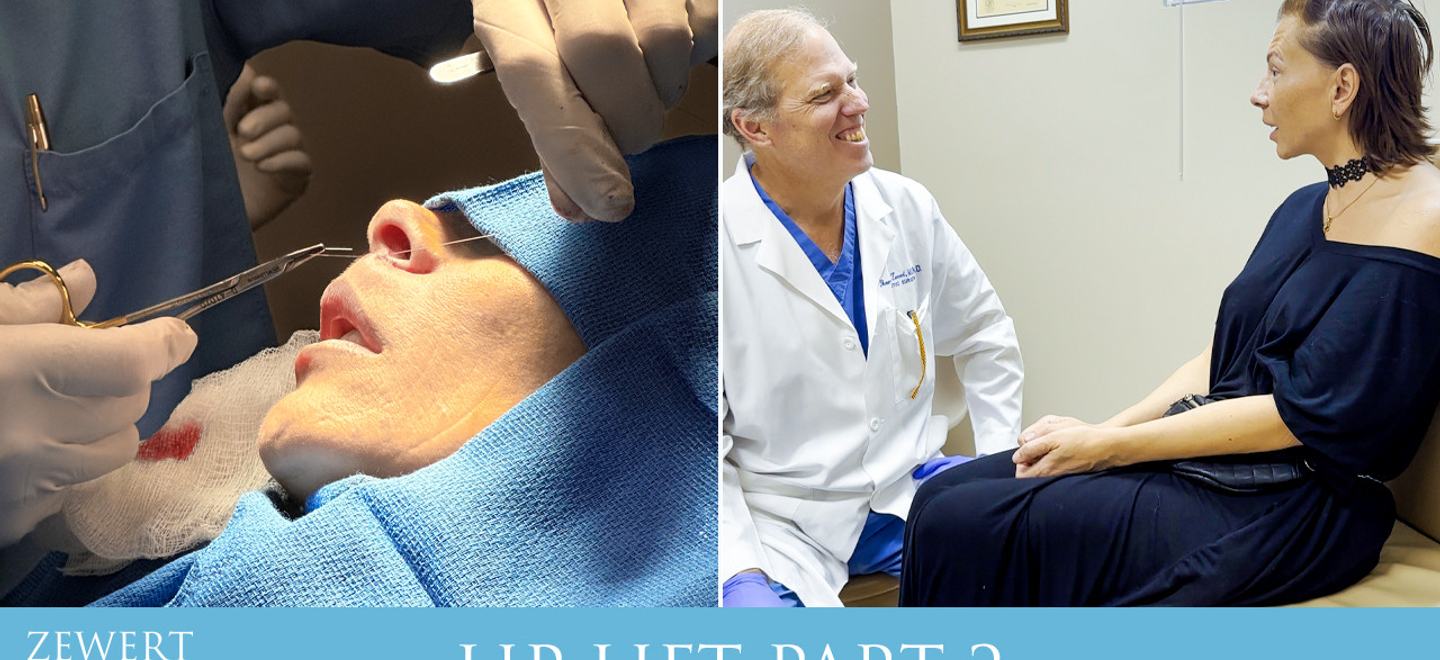 Lip Lift (Part 2)