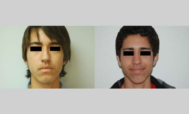 Nose Surgery: Image #141